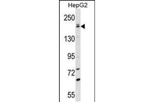 Image no. 1 for anti-Patatin-Like phospholipase Domain Containing 6 (PNPLA6) (AA 1000-1029), (C-Term) antibody (ABIN5537393)