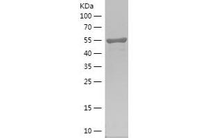 PIP4K2A Protein (AA 208-406) (IF2DI tag)
