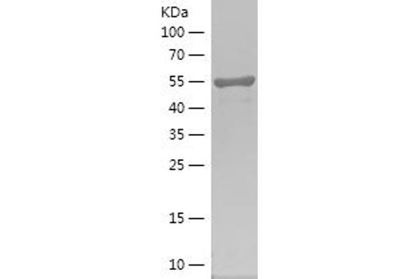 PIP4K2A Protein (AA 208-406) (IF2DI tag)