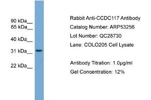 Image no. 2 for anti-Coiled-Coil Domain Containing 117 (CCDC117) (Middle Region) antibody (ABIN2785313)