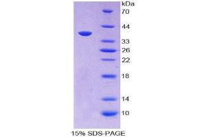 Image no. 1 for Ligase I, DNA, ATP-Dependent (LIG1) (AA 568-875) protein (His tag) (ABIN2124086)
