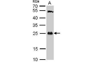 Image no. 5 for anti-Glutathione S-Transferase theta 1 (GSTT1) (full length) antibody (ABIN2856663)