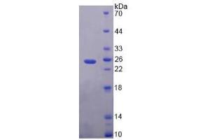 Image no. 1 for Phosphatidylethanolamine Binding Protein 1 (PEBP1) (AA 2-187) protein (T7 tag,His tag) (ABIN6237175)