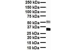 Image no. 4 for anti-Sodium Channel, Voltage-Gated, Type VIII, alpha (SCN8A) (C-Term) antibody (ABIN2776200)