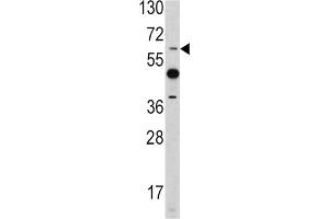 Image no. 1 for anti-Ets Variant 4 (ETV4) antibody (ABIN3002727)