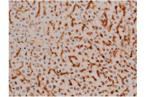Image no. 5 for anti-Ezrin (EZR) (pTyr478) antibody (ABIN6255926)