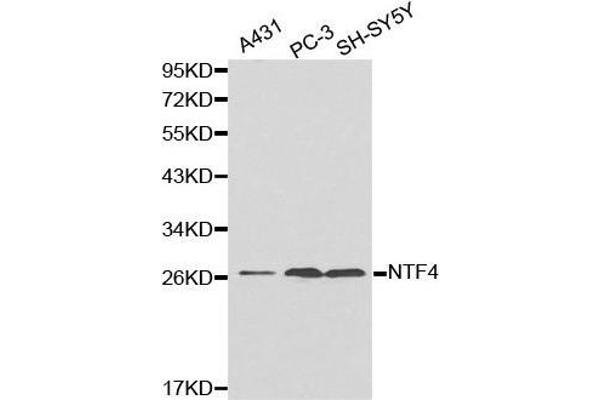 Neurotrophin 4 antibody  (AA 25-210)