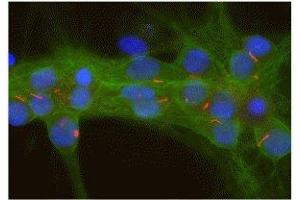 Image no. 2 for anti-Adenylate Cyclase 3 (ADCY3) (C-Term) antibody (ABIN6254060)