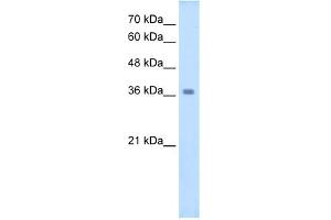 Image no. 1 for anti-Wingless-Type MMTV Integration Site Family, Member 16 (WNT16) (C-Term) antibody (ABIN2776717)