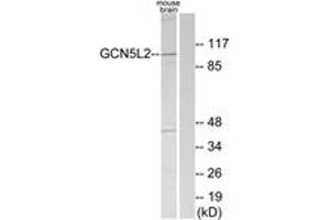 Image no. 1 for anti-K(lysine) Acetyltransferase 2A (KAT2A) (AA 691-740) antibody (ABIN1534045)