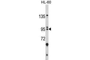 Image no. 1 for anti-Bicaudal C Homolog 1 (BICC1) (N-Term) antibody (ABIN452782)