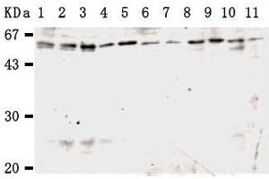 Image no. 1 for anti-Karyopherin alpha 3 (Importin alpha 4) (KPNA3) antibody (ABIN1449200)