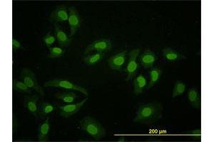 Image no. 1 for anti-Hepatocyte Nuclear Factor 4, alpha (HNF4A) (AA 324-423) antibody (ABIN561308)