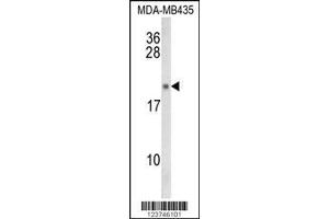 Image no. 1 for anti-Interleukin 21 (IL21) antibody (ABIN2487947)