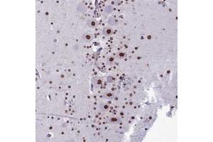 Image no. 1 for anti-PARP1 Binding Protein (PARPBP) antibody (ABIN5585261)