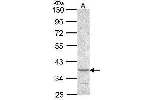 Image no. 1 for anti-Cytohesin 1 Interacting Protein (CYTIP) (N-Term) antibody (ABIN2856346)