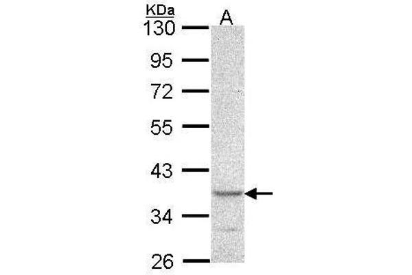 anti-Cytohesin 1 Interacting Protein (CYTIP) (N-Term) antibody