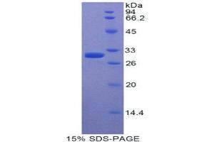 Image no. 1 for Myosin IE (MYO1E) (AA 781-1036) protein (His tag) (ABIN1878002)