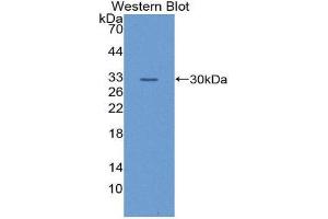 Image no. 1 for anti-Glutathione S-Transferase theta 1 (GSTT1) (AA 7-231) antibody (ABIN1868285)