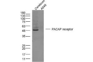 Image no. 2 for anti-Adenylate Cyclase Activating Polypeptide 1 (Pituitary) Receptor Type I (ADCYAP1R1) (AA 251-330) antibody (ABIN726185)