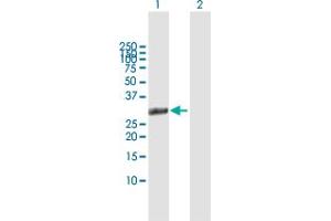 Image no. 2 for anti-Homeobox B1 (HOXB1) (AA 1-235) antibody (ABIN516625)