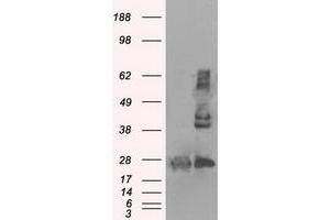 Image no. 5 for anti-Hydroxysteroid (17-Beta) Dehydrogenase 10 (HSD17B10) antibody (ABIN1498724)