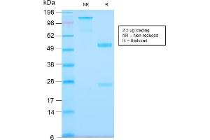 Image no. 1 for anti-Tenascin C (TNC) antibody (ABIN6939677)