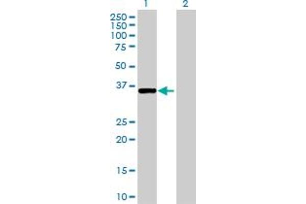 PKDCC anticorps  (AA 1-294)