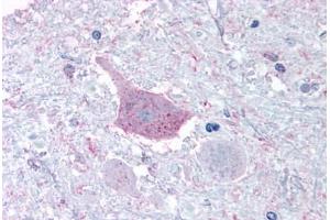 Anti-MRGPRD antibody  ABIN1049069 IHC staining of human brain, medulla.