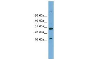 Image no. 1 for anti-T-Cell Acute Lymphocytic Leukemia 2 (TAL2) (AA 51-100) antibody (ABIN6744552)