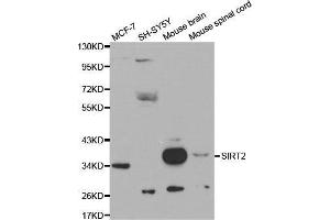 Image no. 2 for anti-Sirtuin 2 (SIRT2) (C-Term) antibody (ABIN3020852)