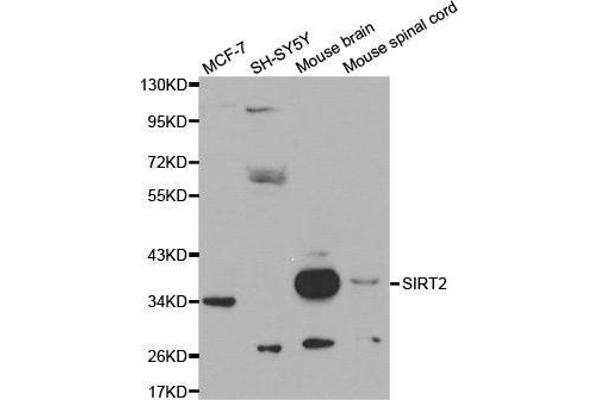 SIRT2 Antikörper  (AA 288-389)