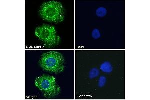Image no. 3 for anti-Actin Related Protein 2/3 Complex, Subunit 2, 34kDa (ARPC2) (C-Term) antibody (ABIN184748)