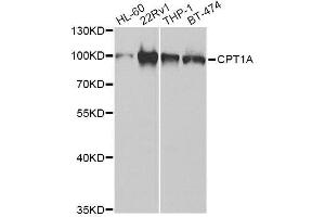 CPT1A Antikörper  (AA 497-756)