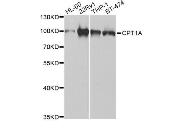 CPT1A Antikörper  (AA 497-756)