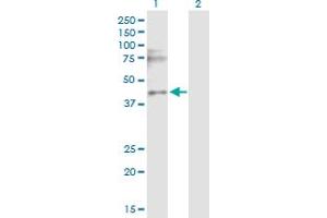 Western Blot analysis of CACNG3 expression in transfected 293T cell line by CACNG3 MaxPab polyclonal antibody.