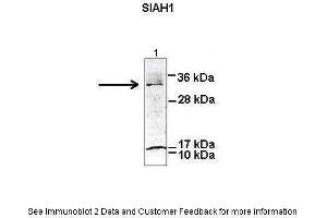 Image no. 2 for anti-E3 Ubiquitin-Protein Ligase SIAH1 (SIAH1) (N-Term) antibody (ABIN2778297)