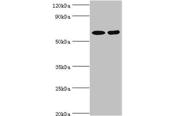 ASMTL Antikörper  (AA 1-290)