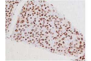 Image no. 11 for anti-Mast/stem Cell Growth Factor Receptor (KIT) (pTyr721) antibody (ABIN6256004)