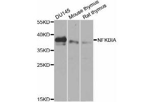 Image no. 5 for anti-Nuclear Factor of kappa Light Polypeptide Gene Enhancer in B-Cells Inhibitor, alpha (NFKBIA) antibody (ABIN3021668)