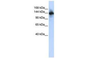 Image no. 1 for anti-RNA Binding Motif Protein 6 (RBM6) (AA 216-265) antibody (ABIN6740261)