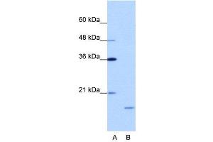 Image no. 1 for anti-Interferon Stimulated Exonuclease Gene 20kDa (ISG20) (N-Term) antibody (ABIN2778795)