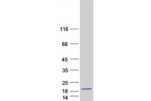 Image no. 1 for Thioredoxin-Like 4A (TXNL4A) protein (Myc-DYKDDDDK Tag) (ABIN2734686)