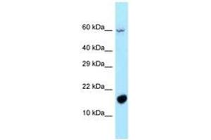 Image no. 1 for anti-Chromosome 5 Open Reading Frame 13 (C5orf13) (AA 13-62) antibody (ABIN6747935)