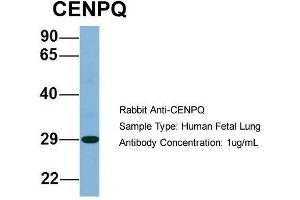 Host: Rabbit  Target Name: CENPQ  Sample Tissue: Human Fetal Lung  Antibody Dilution: 1.