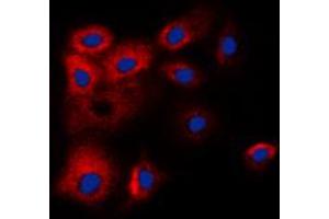 Image no. 2 for anti-BCL2-Like 2 (BCL2L2) (C-Term) antibody (ABIN2704523)