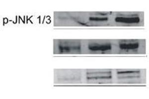 JNK Antikörper  (pThr183, pTyr185)