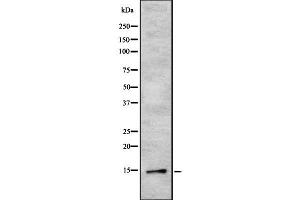 Image no. 1 for anti-Tumor Protein D52-Like 3 (TPD52L3) (N-Term) antibody (ABIN6265685)