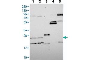 NUDT16L1 抗体