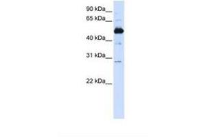 Image no. 1 for anti-Family with Sequence Similarity 134, Member B (FAM134B) (AA 254-303) antibody (ABIN6738133)